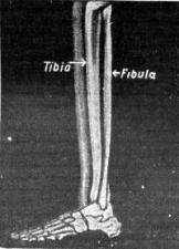 Fibula | Encyclopedia.com